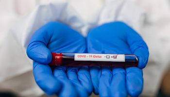 Healthcare worker, holding the example of blood test, positive on new Delta strain, of COVID-19 virus