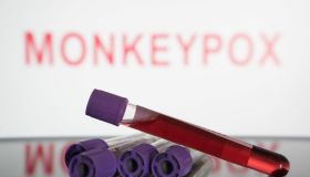 Monkeypox Photo Illustrations