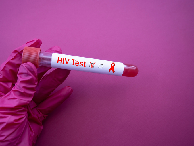 Blood collection tube with HIV test. The doctor's hand holds a positive blood sample for the infection. Red Ribbon HIV, AIDS.