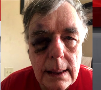 Esta foto se tomó poco después del incidente