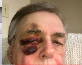 Foto de las lesiones de Gooding desde otro ángulo