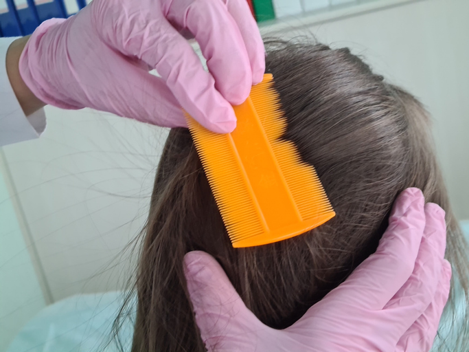 Closeup of doctor examining girl hair with comb